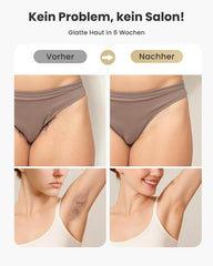 HAARLOSY IPL naprava za odstranjevanje dlak